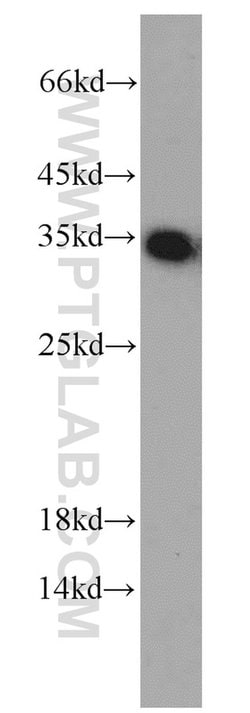 EEF1B2 Rabbit anti-Human, Mouse, Rat, Polyclonal, Proteintech 150 &mu;L;