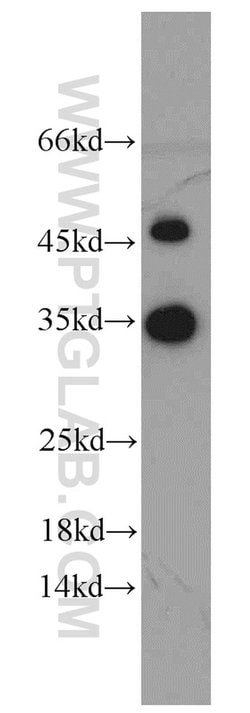 EEF1B2 Rabbit anti-Human, Mouse, Rat, Polyclonal, Proteintech 150 &mu;L;