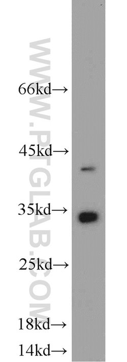 EEF1B2 Rabbit anti-Human, Mouse, Rat, Polyclonal, Proteintech 150 &mu;L;