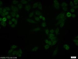JUNB Rabbit anti-Human, Mouse, Rat, Polyclonal, Proteintech:Antibodies:Primary