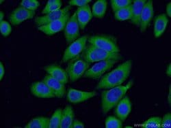 S100A14 Rabbit anti-Human, Mouse, Rat, Polyclonal, Proteintech 150 &mu;L;