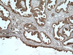 S100A14 Rabbit anti-Human, Mouse, Rat, Polyclonal, Proteintech 150 &mu;L;