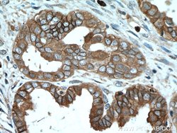 S100A14 Rabbit anti-Human, Mouse, Rat, Polyclonal, Proteintech 150 &mu;L;