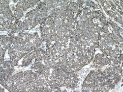 S100A14 Rabbit anti-Human, Mouse, Rat, Polyclonal, Proteintech 150 &mu;L;