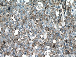 S100A14 Rabbit anti-Human, Mouse, Rat, Polyclonal, Proteintech 150 &mu;L;