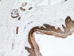 S100A14 Rabbit anti-Human, Mouse, Rat, Polyclonal, Proteintech 150 &mu;L;
