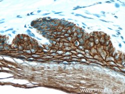 S100A14 Rabbit anti-Human, Mouse, Rat, Polyclonal, Proteintech 150 &mu;L;