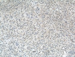 S100A14 Rabbit anti-Human, Mouse, Rat, Polyclonal, Proteintech 150 &mu;L;