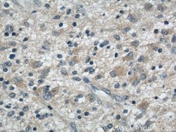 S100A14 Rabbit anti-Human, Mouse, Rat, Polyclonal, Proteintech 150 &mu;L;