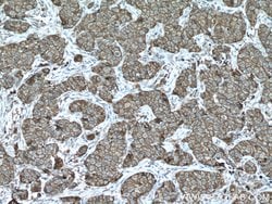 S100A14 Rabbit anti-Human, Mouse, Rat, Polyclonal, Proteintech 150 &mu;L;