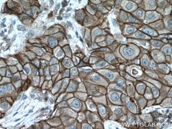 S100A14 Rabbit anti-Human, Mouse, Rat, Polyclonal, Proteintech 150 &mu;L;