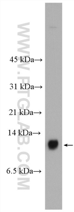 S100A14 Rabbit anti-Human, Mouse, Rat, Polyclonal, Proteintech 150 &mu;L;
