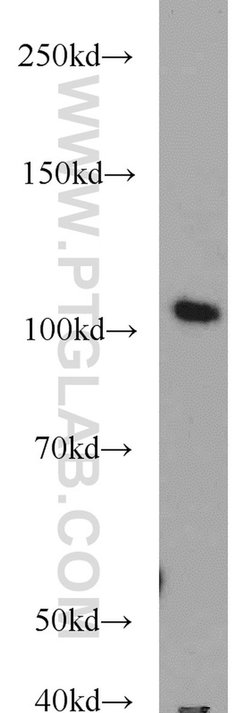TCEB3 Rabbit anti-Human, Mouse, Rat, Polyclonal, Proteintech 20 &mu;L;