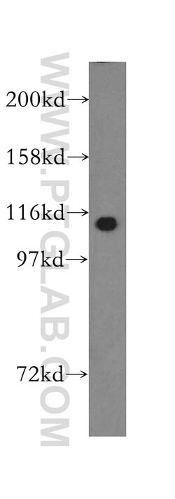 TCEB3 Rabbit anti-Human, Mouse, Rat, Polyclonal, Proteintech 20 &mu;L;