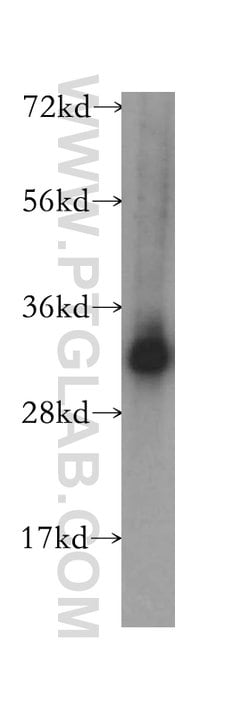 ZMAT3 Rabbit anti-Human, Mouse, Rat, Polyclonal, Proteintech:  