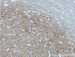 NCS1 Rabbit anti-Human, Mouse, Rat, Polyclonal, Proteintech 150 &mu;L;