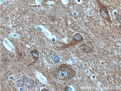 NCS1 Rabbit anti-Human, Mouse, Rat, Polyclonal, Proteintech 150 &mu;L;