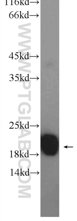 NCS1 Rabbit anti-Human, Mouse, Rat, Polyclonal, Proteintech 150 &mu;L;