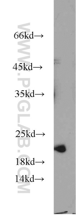 NCS1 Rabbit anti-Human, Mouse, Rat, Polyclonal, Proteintech 150 &mu;L;