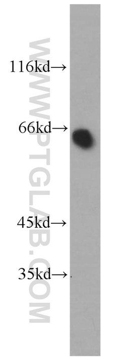 PDZK1 Rabbit anti-Human, Mouse, Rat, Polyclonal, Proteintech:Antibodies:Primary
