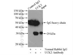 UCK2 Rabbit anti-Human, Mouse, Rat, Polyclonal, Proteintech 150 &mu;L;