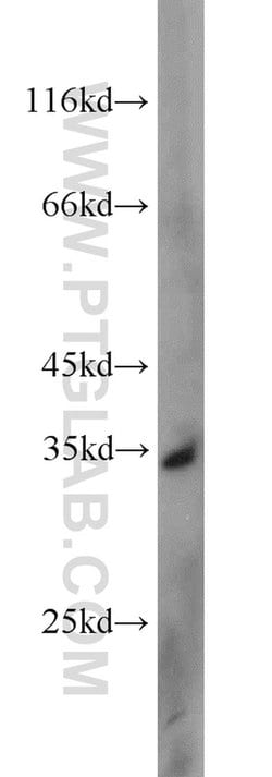 UCK2 Rabbit anti-Human, Mouse, Rat, Polyclonal, Proteintech 150 &mu;L;