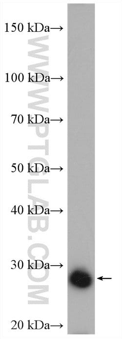UCK2 Rabbit anti-Human, Mouse, Rat, Polyclonal, Proteintech 150 &mu;L;