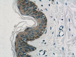 PACSIN2 Rabbit anti-Human, Mouse, Polyclonal, Proteintech:Antibodies:Primary