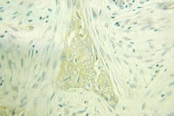 PACSIN2 Rabbit anti-Human, Mouse, Polyclonal, Proteintech:Antibodies:Primary
