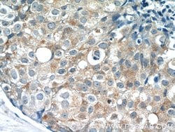 PACSIN2 Rabbit anti-Human, Mouse, Polyclonal, Proteintech:Antibodies:Primary