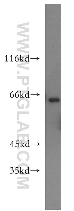 PACSIN2 Rabbit anti-Human, Mouse, Polyclonal, Proteintech:Antibodies:Primary