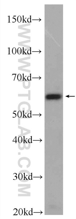 PACSIN2 Rabbit anti-Human, Mouse, Polyclonal, Proteintech:Antibodies:Primary