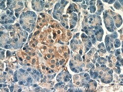 PCMT1 Rabbit anti-Human, Mouse, Rat, Polyclonal, Proteintech:Anticuerpos:Anticuerpos