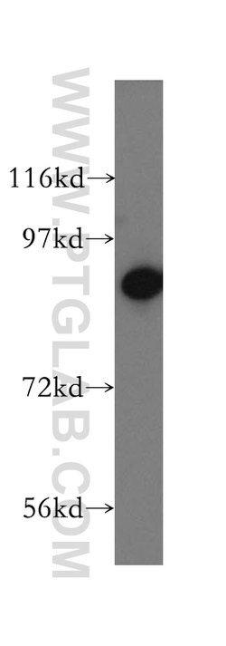 RRM1 Rabbit anti-Human, Mouse, Non-human primate, Rat, Polyclonal, Proteintech