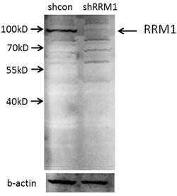 RRM1 Rabbit anti-Human, Mouse, Non-human primate, Rat, Polyclonal, Proteintech