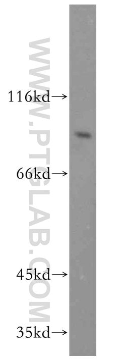 RRM1 Rabbit anti-Human, Mouse, Non-human primate, Rat, Polyclonal, Proteintech