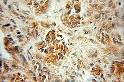 PDLIM5 Rabbit anti-Human, Mouse, Rat, Polyclonal, Proteintech 150 &mu;L;