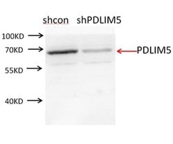 PDLIM5 Rabbit anti-Human, Mouse, Rat, Polyclonal, Proteintech 150 &mu;L;
