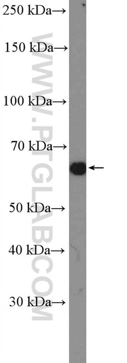 PDLIM5 Rabbit anti-Human, Mouse, Rat, Polyclonal, Proteintech 150 &mu;L;
