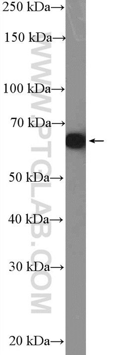 PDLIM5 Rabbit anti-Human, Mouse, Rat, Polyclonal, Proteintech 150 &mu;L;