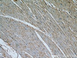 Calpain 1 Rabbit anti-Human, Mouse, Rat, Polyclonal, Proteintech 150 μL;