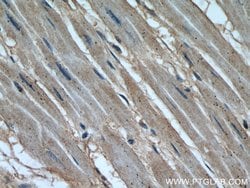 Calpain 1 Rabbit anti-Human, Mouse, Rat, Polyclonal, Proteintech 150 μL;