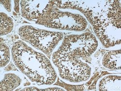 Calpain 1 Rabbit anti-Human, Mouse, Rat, Polyclonal, Proteintech 150 μL;