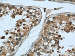 Calpain 1 Rabbit anti-Human, Mouse, Rat, Polyclonal, Proteintech 150 μL;