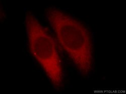Calpain 1 Rabbit anti-Human, Mouse, Rat, Polyclonal, Proteintech 150 μL;