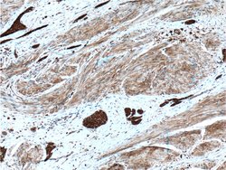 Calpain 1 Rabbit anti-Human, Mouse, Rat, Polyclonal, Proteintech 150 μL;