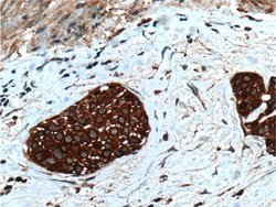 Calpain 1 Rabbit anti-Human, Mouse, Rat, Polyclonal, Proteintech 150 μL;