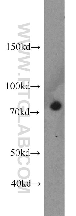 Calpain 1 Rabbit anti-Human, Mouse, Rat, Polyclonal, Proteintech 150 μL;
