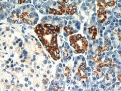 MAOA Rabbit anti-Human, Polyclonal, Proteintech:Antibodies:Primary Antibodies