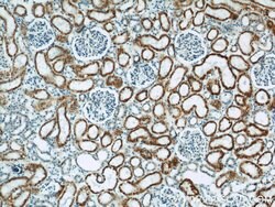 MAOA Rabbit anti-Human, Polyclonal, Proteintech:Antibodies:Primary Antibodies